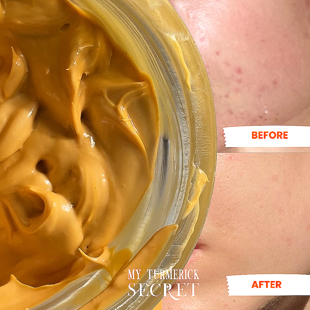 Deep Hydration Support