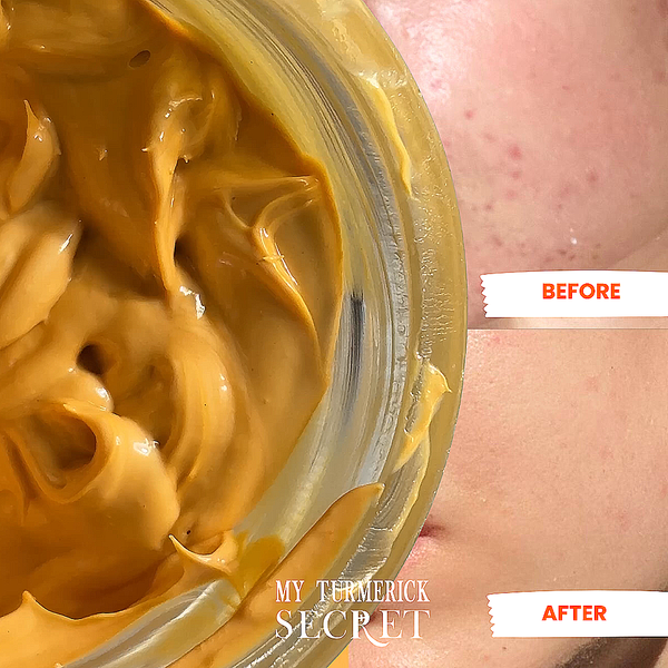 Deep Hydration Support