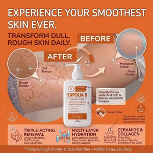Exfolia 5 Exfoliating Body Lotion (220ml) - My Turmerick Secret