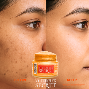 Before and after results of 24k gold turmeric face mask by My Turmerick Secret showing clearer, smoother skin.Detoxify & Purify: Draws out impurities and excess oils, minimizing the appearance of pores and leaving your skin feeling fresh, smooth, and refined.

Suitable for All Skin Types: A gentle yet effective formulation designed to rejuvenate and nourish normal, dry, oily, and sensitive skin.