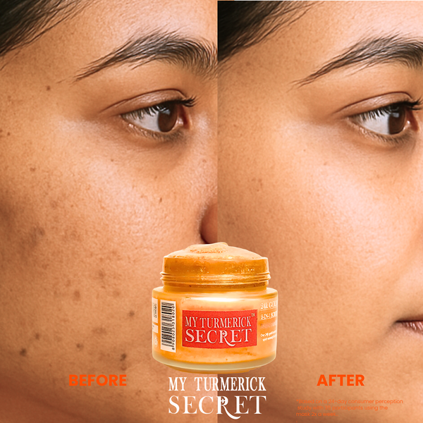Before and after results of 24k gold turmeric face mask by My Turmerick Secret showing clearer, smoother skin.Detoxify & Purify: Draws out impurities and excess oils, minimizing the appearance of pores and leaving your skin feeling fresh, smooth, and refined.

Suitable for All Skin Types: A gentle yet effective formulation designed to rejuvenate and nourish normal, dry, oily, and sensitive skin.