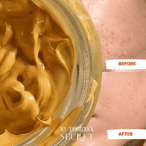 Pumpkin Face mask by My Turmerick Secret showing before and after effects on hyper pigmentation with exfoliator glycolic mask no tan face pack